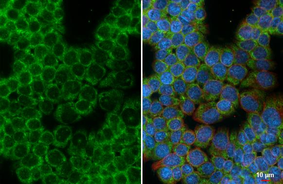 GPR77 Antibody in Immunocytochemistry (ICC/IF)