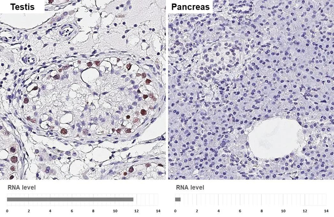 NEIL2 Antibody in Immunohistochemistry (Paraffin) (IHC (P))