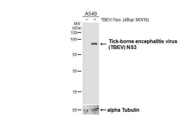 Tick-Borne Encephalitis Virus NS3 Antibody in Western Blot (WB)