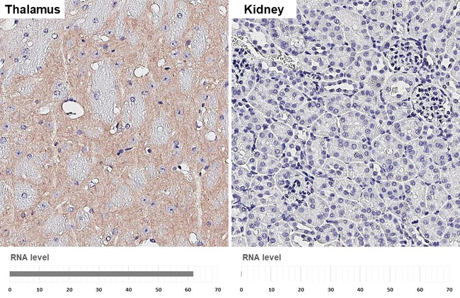 BAI1 Antibody in Immunohistochemistry (Paraffin) (IHC (P))