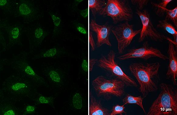 YY1 Antibody in Immunocytochemistry (ICC/IF)