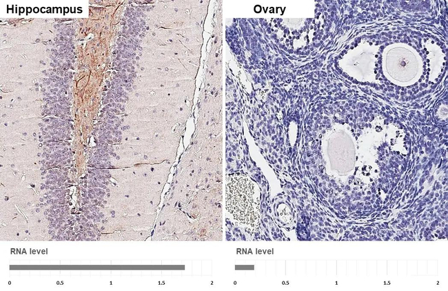 BDNF Antibody in Immunohistochemistry (Paraffin) (IHC (P))