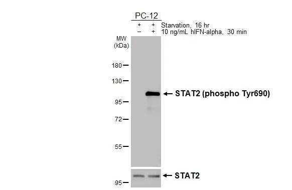 Phospho-STAT2 (Tyr690) Antibody in Western Blot (WB)