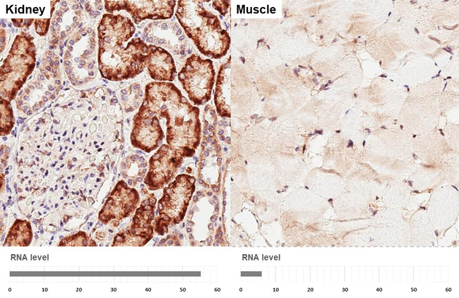 SLC25A1 Antibody in Immunohistochemistry (Paraffin) (IHC (P))