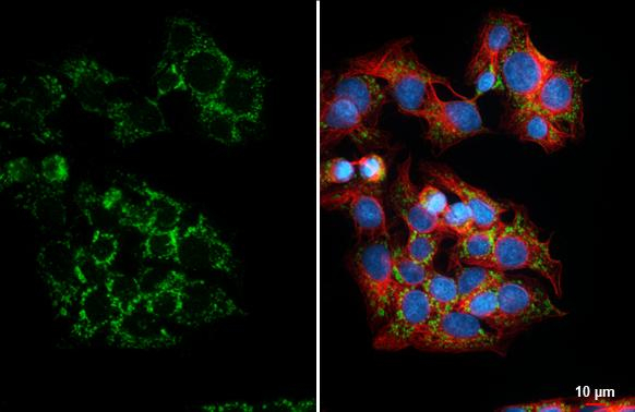 SLC25A1 Antibody in Immunocytochemistry (ICC/IF)