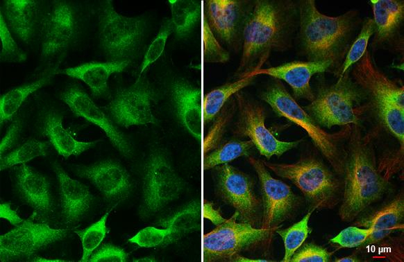 NFkB p65 Antibody in Immunocytochemistry (ICC/IF)