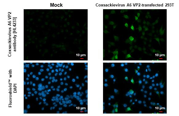 Coxsackievirus A6 VP2 Antibody in Immunocytochemistry (ICC/IF)