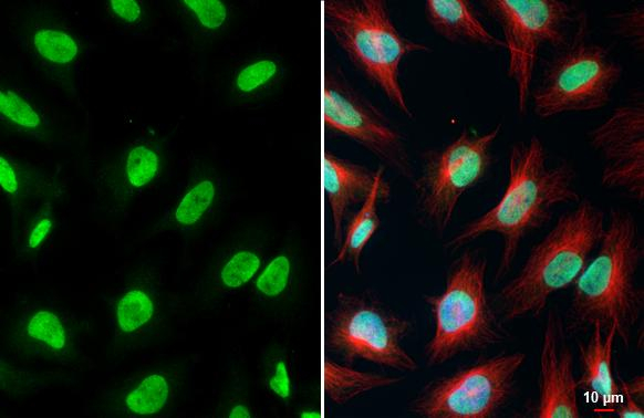 LSD1 Antibody in Immunocytochemistry (ICC/IF)