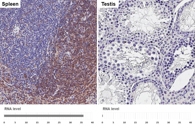 Syk Antibody in Immunohistochemistry (Paraffin) (IHC (P))