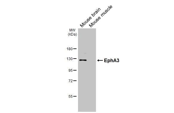 EphA3 Antibody in Western Blot (WB)