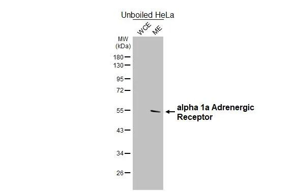 alpha-1a Adrenergic Receptor Antibody in Western Blot (WB)