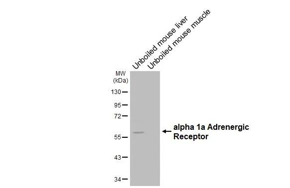 alpha-1a Adrenergic Receptor Antibody in Western Blot (WB)