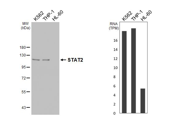 STAT2 Antibody in Western Blot (WB)