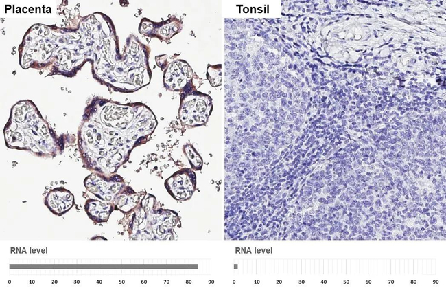 GDF15 Antibody in Immunohistochemistry (Paraffin) (IHC (P))