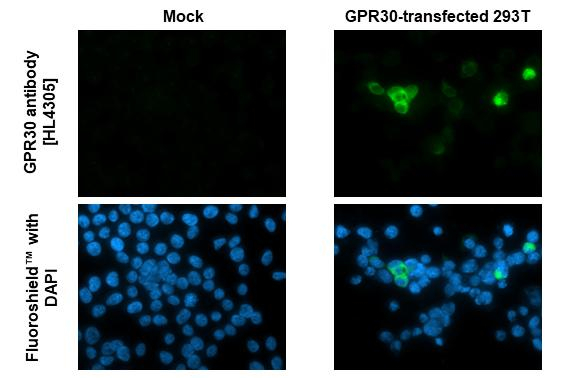 GPR30 Antibody in Immunocytochemistry (ICC/IF)