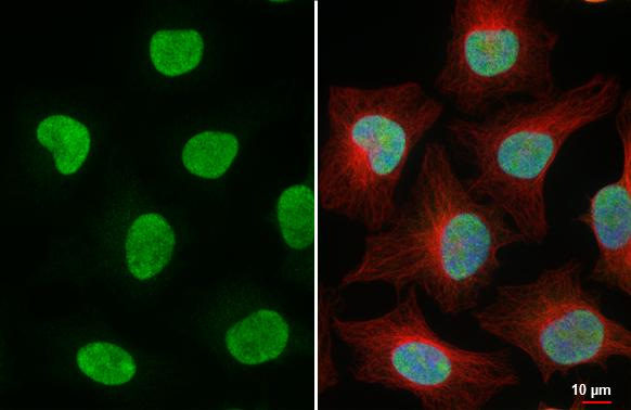 ESRRA Antibody in Immunocytochemistry (ICC/IF)