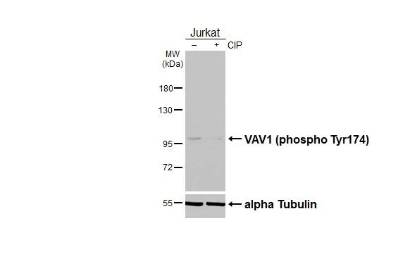 Phospho-VAV1 (Tyr174) Antibody in Western Blot (WB)