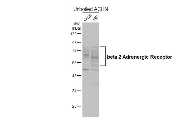 beta-2 Adrenergic Receptor Antibody in Western Blot (WB)