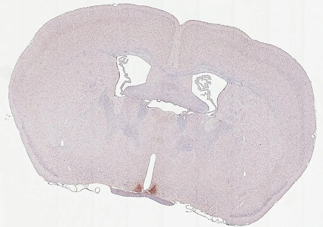 VIP Antibody in Immunohistochemistry (Paraffin) (IHC (P))