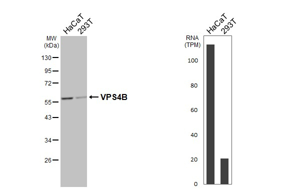 VPS4B Antibody in Western Blot (WB)