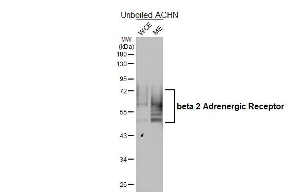 beta-2 Adrenergic Receptor Antibody in Western Blot (WB)