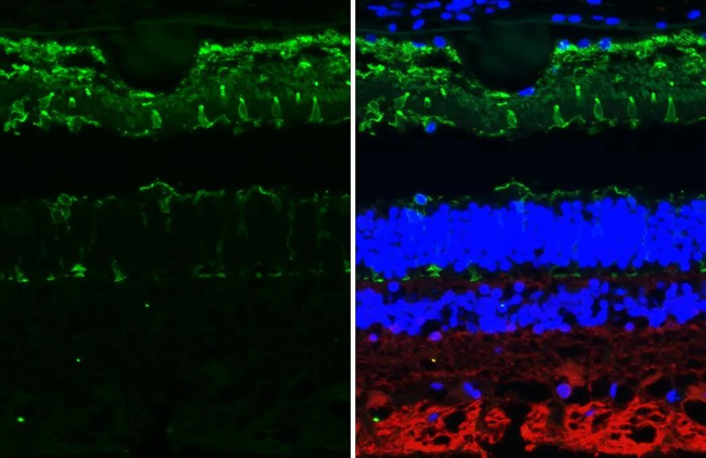 Opsin Blue Antibody in Immunohistochemistry (Paraffin) (IHC (P))