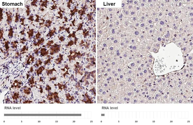 CD63 Antibody in Immunohistochemistry (Paraffin) (IHC (P))