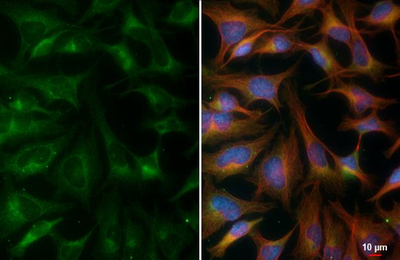 POLG Antibody in Immunocytochemistry (ICC/IF)