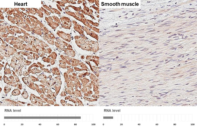 ATP5D Antibody in Immunohistochemistry (Paraffin) (IHC (P))
