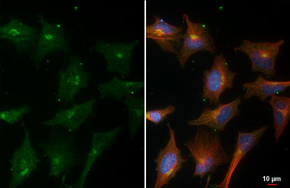 GALNT2 Antibody in Immunocytochemistry (ICC/IF)