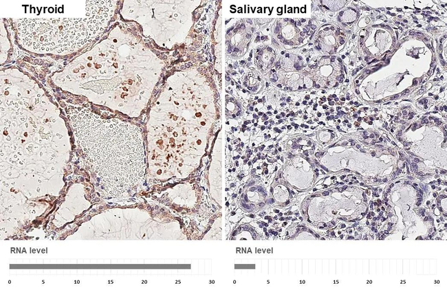ADAM10 Antibody in Immunohistochemistry (Paraffin) (IHC (P))
