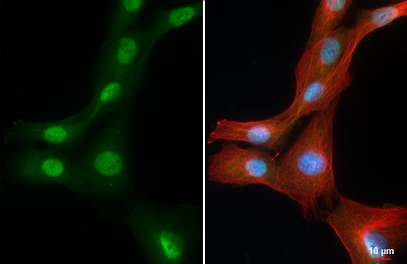 LOXL2 Antibody in Immunocytochemistry (ICC/IF)