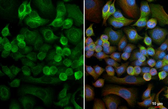 INHBB Antibody in Immunocytochemistry (ICC/IF)