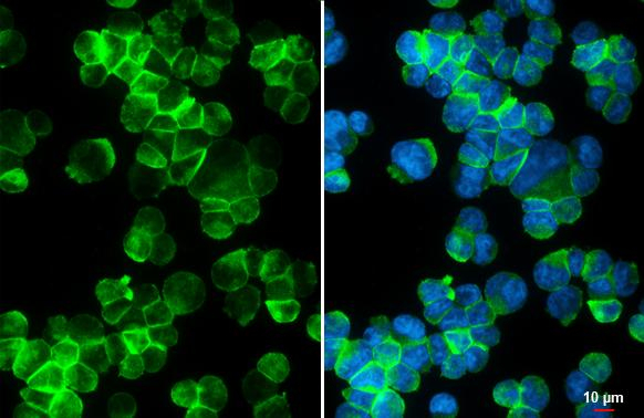 P2Y11 Antibody in Immunocytochemistry (ICC/IF)