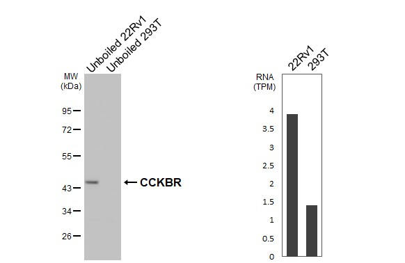 CCKBR Antibody in Western Blot (WB)