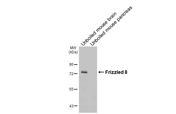 FZD8 Antibody in Western Blot (WB)