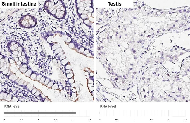 HTR4 Antibody in Immunohistochemistry (Paraffin) (IHC (P))