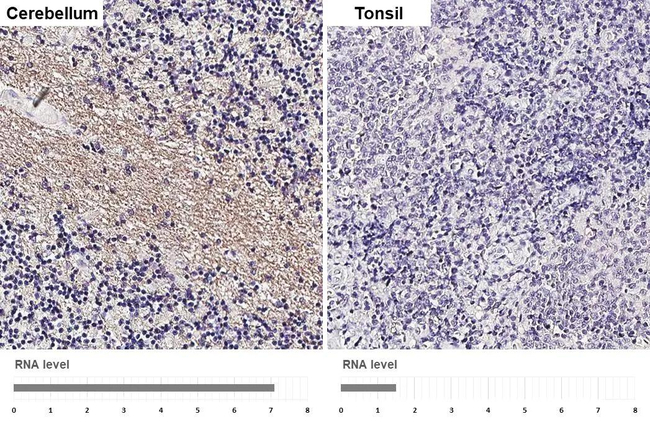 EDG8 Antibody in Immunohistochemistry (Paraffin) (IHC (P))
