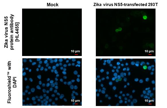 Zika Virus NS5 Antibody in Immunocytochemistry (ICC/IF)