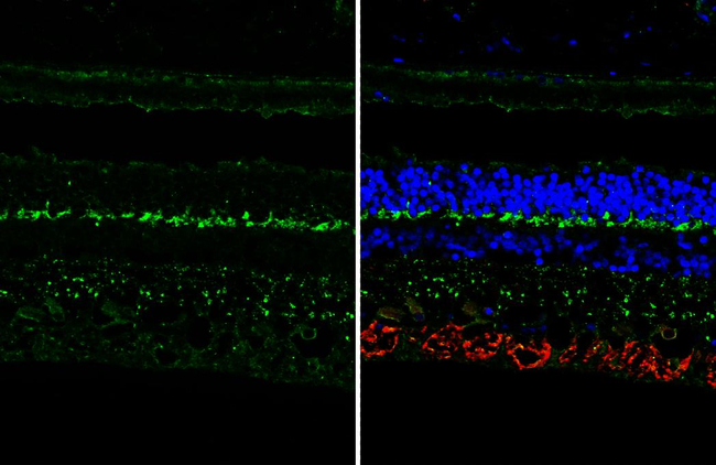 mGluR6 Antibody in Immunohistochemistry (Paraffin) (IHC (P))