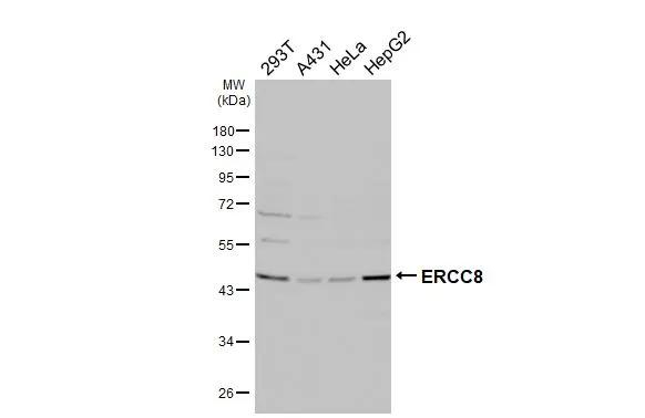 ERCC8 Antibody in Western Blot (WB)