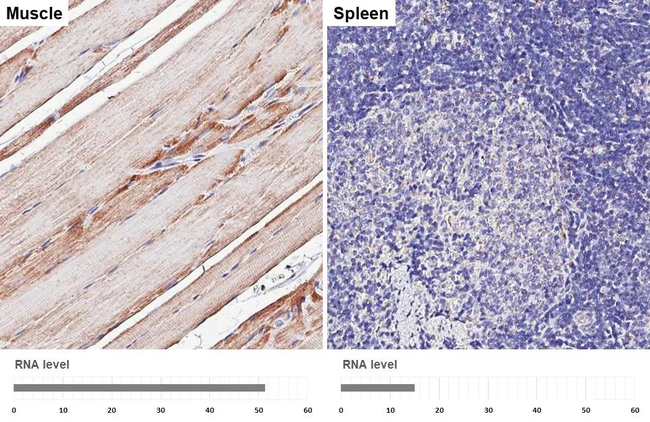 VDAC2 Antibody in Immunohistochemistry (Paraffin) (IHC (P))