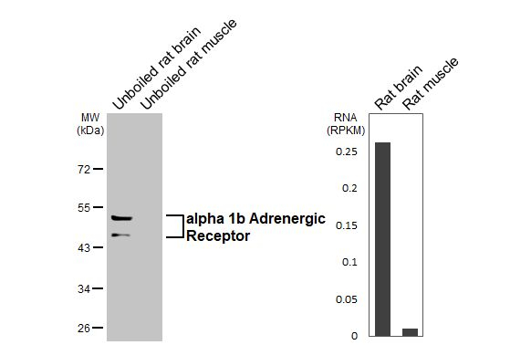alpha-1b Adrenergic Receptor Antibody in Western Blot (WB)