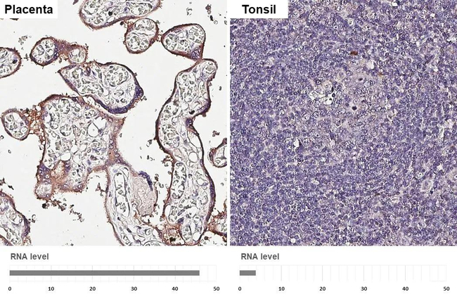 GPR126 Antibody in Immunohistochemistry (Paraffin) (IHC (P))