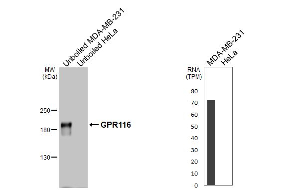 GPR116 Antibody in Western Blot (WB)