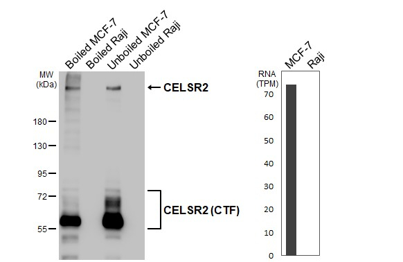 CELSR2 Antibody in Western Blot (WB)