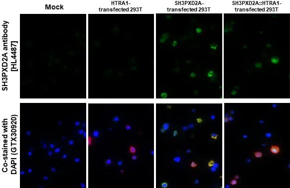 SH3PXD2A Antibody in Immunohistochemistry (Paraffin) (IHC (P))