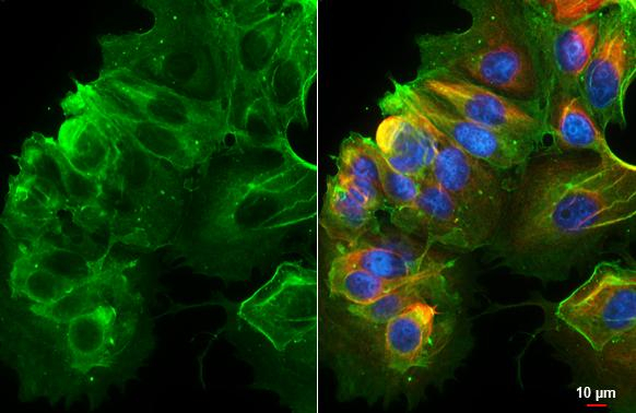 alpha-2b Adrenergic Receptor Antibody in Immunocytochemistry (ICC/IF)