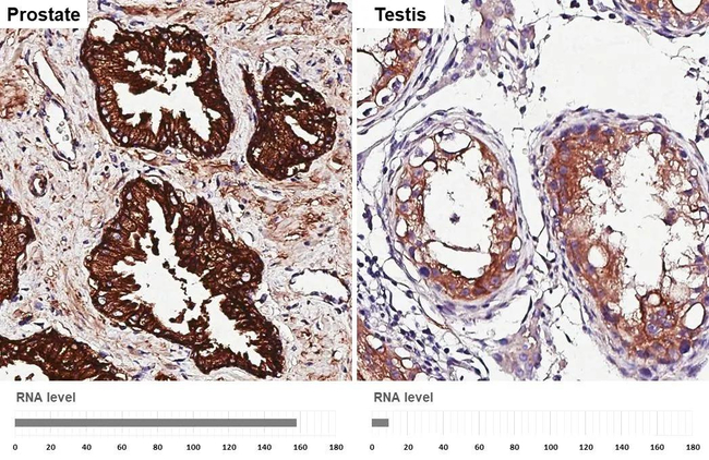 CD9 Antibody in Immunohistochemistry (Paraffin) (IHC (P))