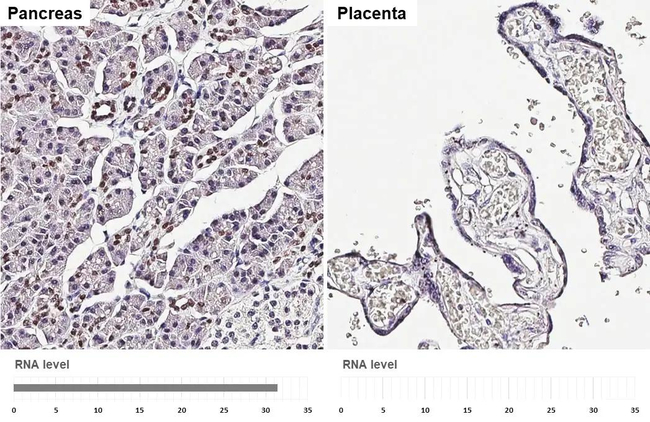 TCF2 Antibody in Immunohistochemistry (Paraffin) (IHC (P))